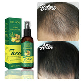 Ginger Hair Growth Serum Sprayer Fast Hair Growth Dense Regrowth Ginger Serum Oil Natural Hair Growth Accelerator For Stronger
