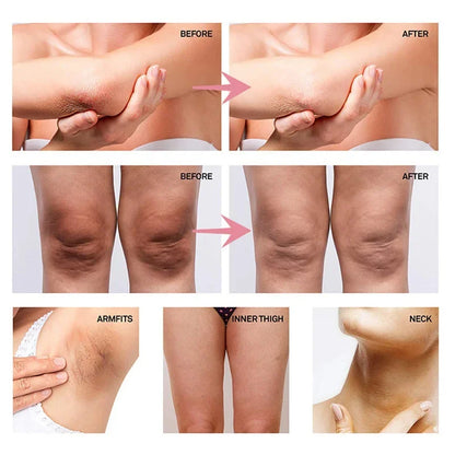 Crema blanqueadora para partes íntimas, suero blanqueador de axilas, blanquea glúteos y rodillas, aclara la parte interna del muslo, oscurece las partes íntimas y elimina la melanina.
