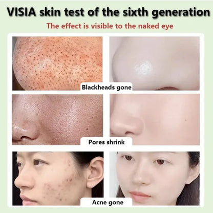 Original Green Tea Deep Remove Blackheads Acne Mud Mask Stick Shrink Pores Dispel Acne Cream Treat Pimple Korean Clean Skin Care