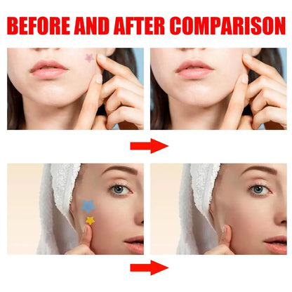 200pcs Colorful Star-Shaped Hydrocolloid Invisible Pimple Patches For Face, Cute Zit Cover Stickers Skin Care