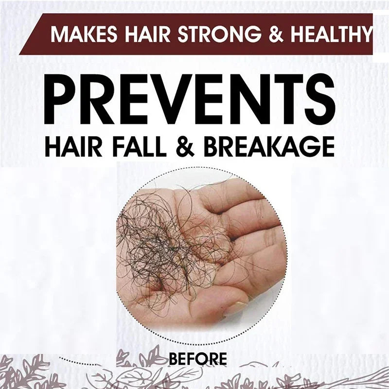 Fast Hair Growth for Men and Women, Ginger Hair Growth Oil, Hair Care, Anti-Hair Loss Treatment, Scalp Serum, Beauty and Health Products