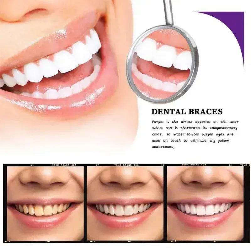 Pasta dental blanqueadora morada V34 de 30 ml. Elimina manchas, reduce el amarilleo y cuida tus dientes, encías, aliento fresco y blanquea los dientes.