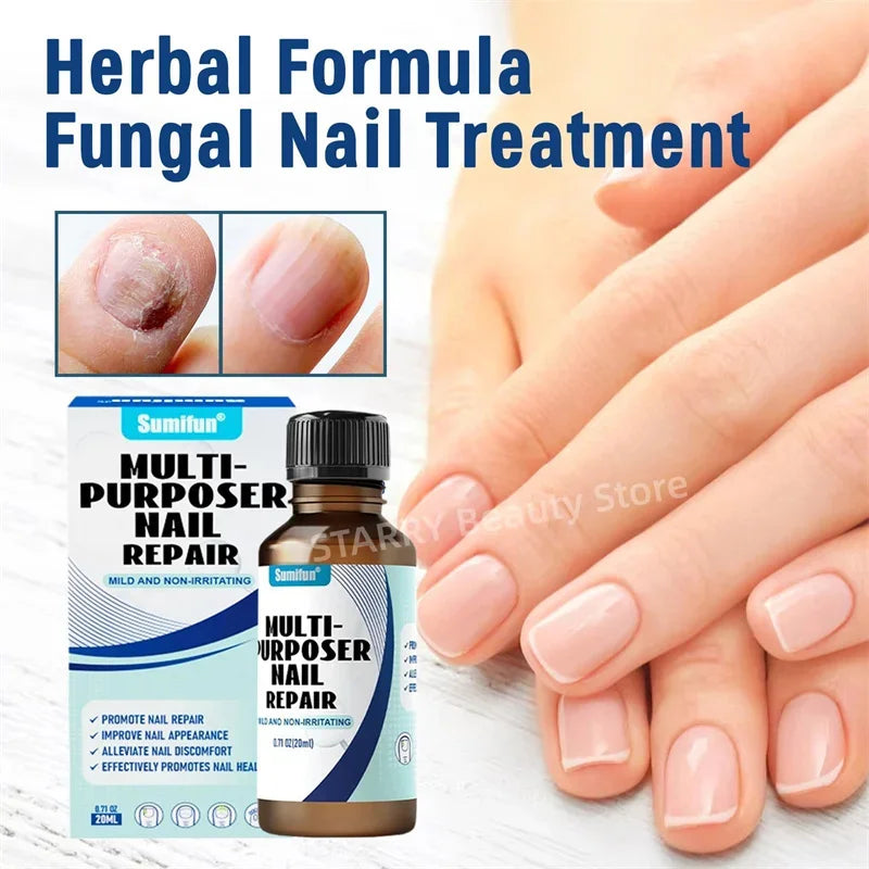 Fungal Nail Tratamento Soro, Foot Care Essence, Fungus Removal Repair Gel, Paroníquia Anti Infecção e Onicomicose