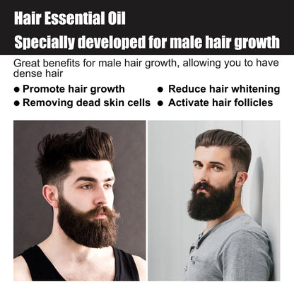 Vitamina E óleo de crescimento capilar para homens, prevenir a calvície, reparar, danificado, fortalecer raízes, melhorar a perda, reduzir o frizz, soro essencial