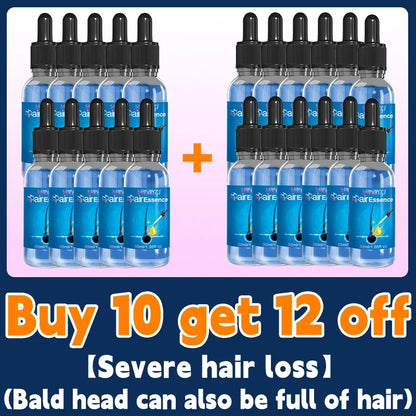 Este es absolutamente el producto para el crecimiento del cabello más eficaz del siglo XXI que ha ayudado a millones de personas a deshacerse de la pérdida del cabello y la calvicie, 100% efectivo.