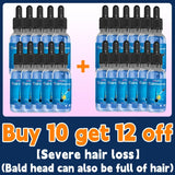 Este é absolutamente o produto para crescimento capilar mais eficaz do século XXI, que ajudou milhões de pessoas a se livrar da queda de cabelo e da calvície, 100% eficaz.
