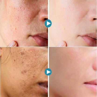 Pore Shrink Face Serum Remove Blackheads Acne Acidity Oil Control Repair Essence Moisturizing Nourish Pores Firming Facial Care