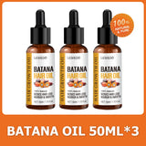 Óleo de Batana Lewedo Naturals – Crescimento Acelerado do Cabelo para Homens e Mulheres – Óleo de Batana Puro – Nutrição e Brilho – Cuidado Capilar Saudável – Combate à Queda