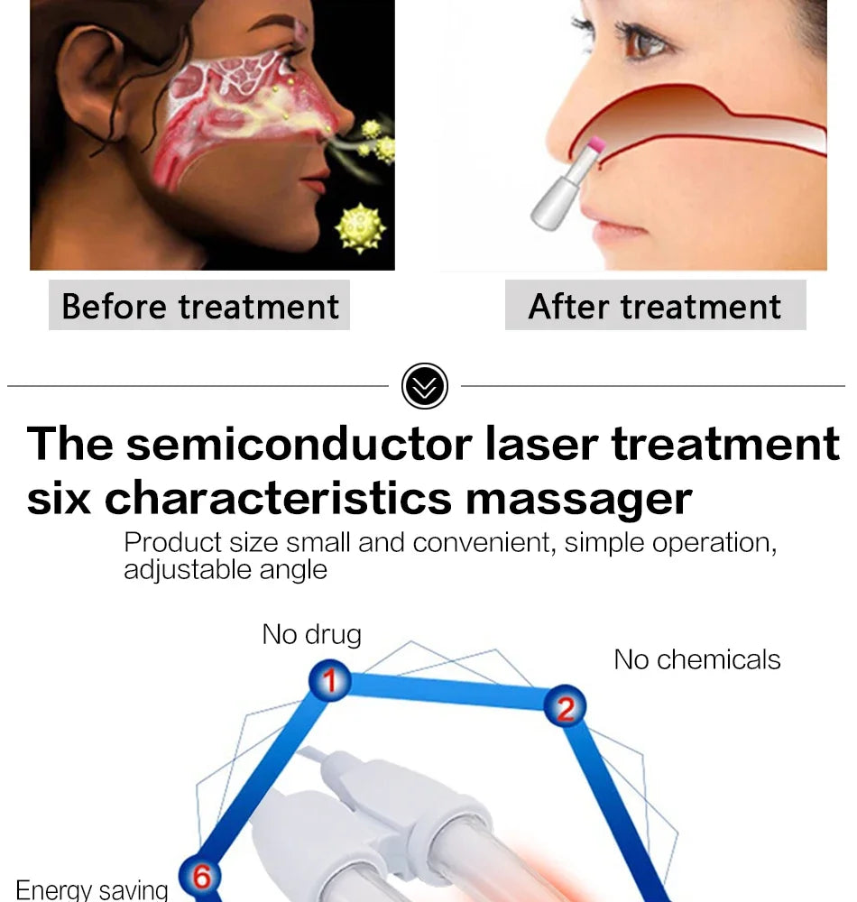 Rhinitis Relief Instrument Sinusitis Therapy Massage Machine Hay fever Low Frequency Pulse Laser Pen Nose Treatment Health Care