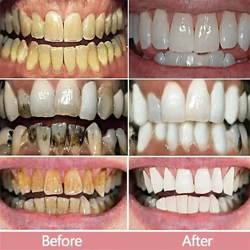 New Teeth Whitening Toothpaste 5D Oral Hygiene Cleaning Teeth Whitening Tool Fresh Breath Teeth Care