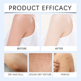 Body Care Patch Nourishes&Cares For The Skin Providing Comfort Enhancing Youthful Vitality&Improving Skin ConditionPortablePatch