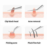 Acne Needle Tweezers Light Blackhead Blemish Pimples Removal Pointed Bend Head Face Care Tools Acne Extractor Beauty-health