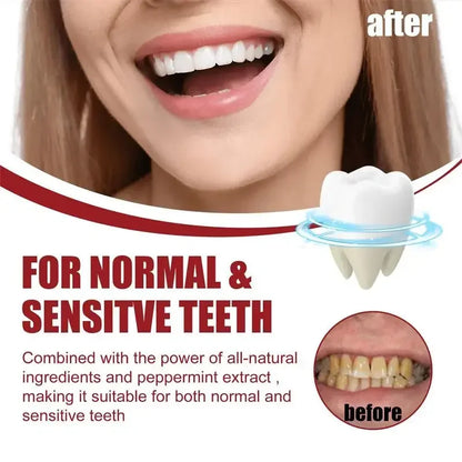 SP-10 Probiotic Toothpaste Whiten Tooth Remove Plaque Stains Teeth Whitener Oral Hygiene Clean Fresh Breath Teeth Care Product