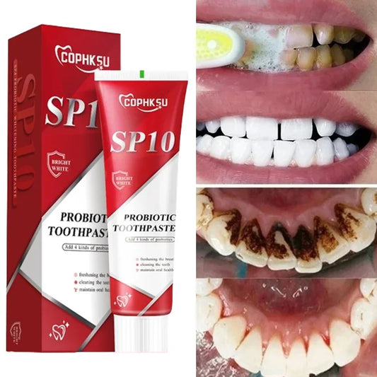 Pasta dental probiótica SP-10. Blanquea los dientes, elimina la placa y las manchas. Blanquea los dientes. Higiene bucal. Aliento fresco. Producto para el cuidado dental.