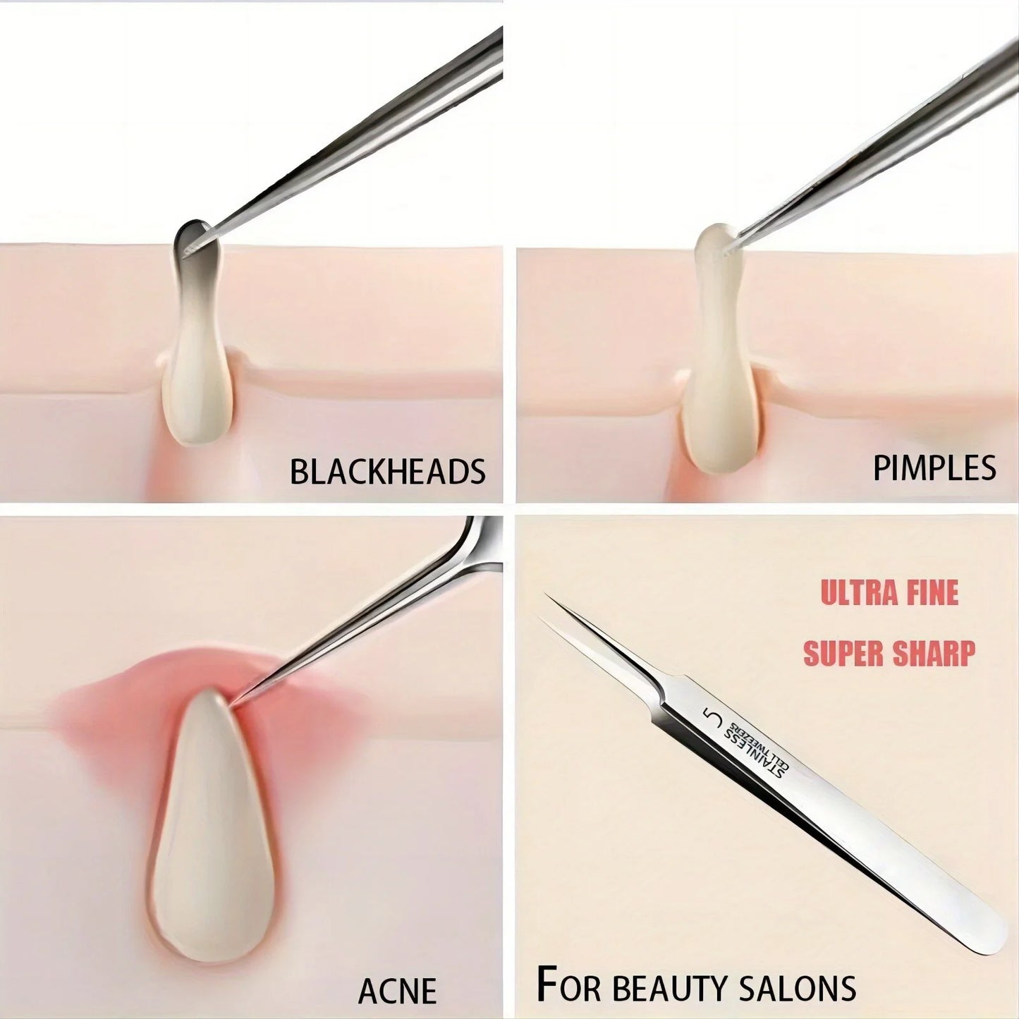 Pinzas extrafinas n.° 5 para puntos negros y acné - Herramientas de belleza facial para eliminar el acné y el cuidado de la piel