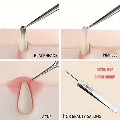 Pinzas extrafinas n.° 5 para puntos negros y acné - Herramientas de belleza facial para eliminar el acné y el cuidado de la piel
