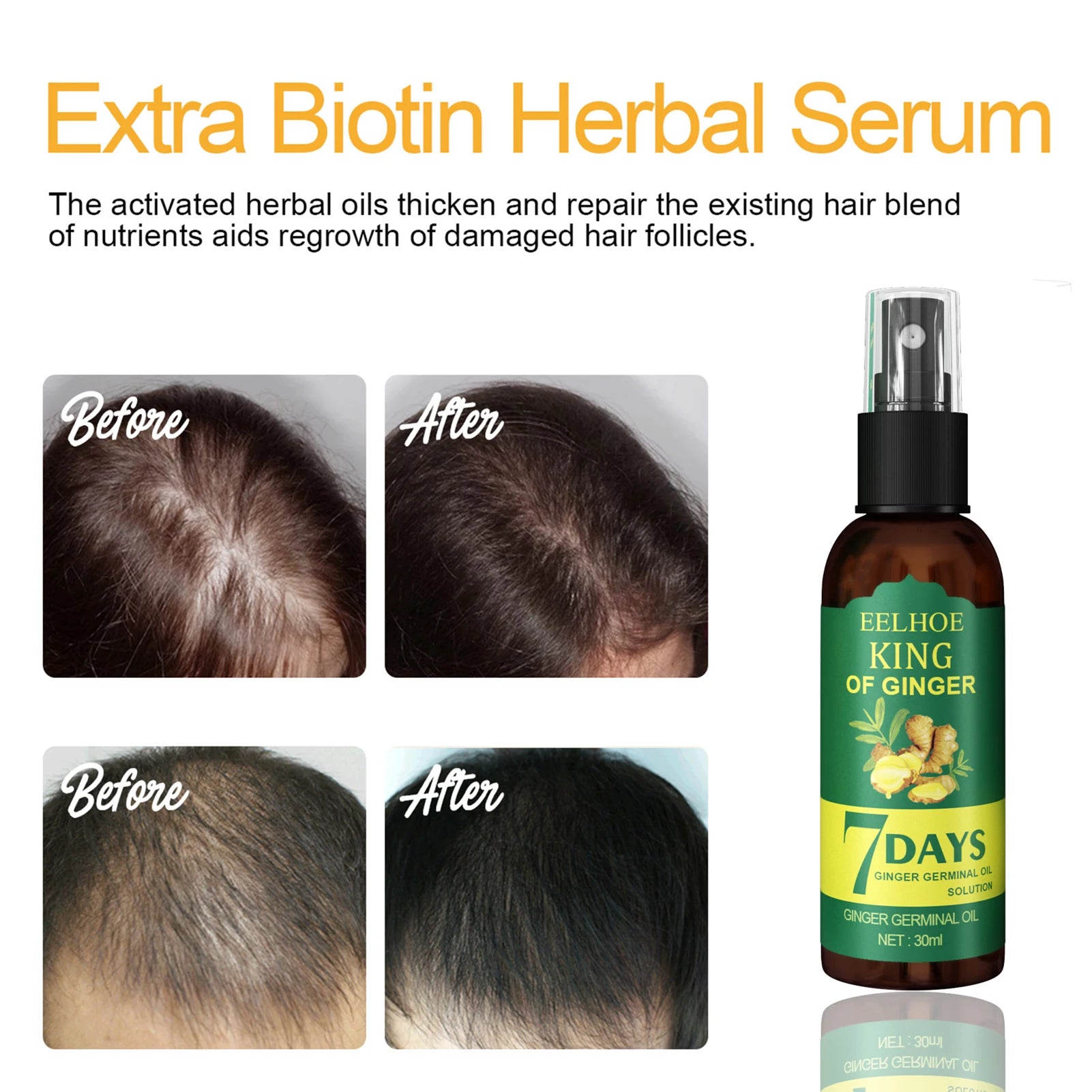 Ginger Hair Growth Serum Sprayer Fast Hair Growth Dense Regrowth Ginger Serum Oil Natural Hair Growth Accelerator For Stronger