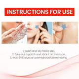 216PCS Pimple Patch Acne Colorful Invisible Acne Removal Skin Care Stickers Concealer Face Spot Beauty Makeup Tools