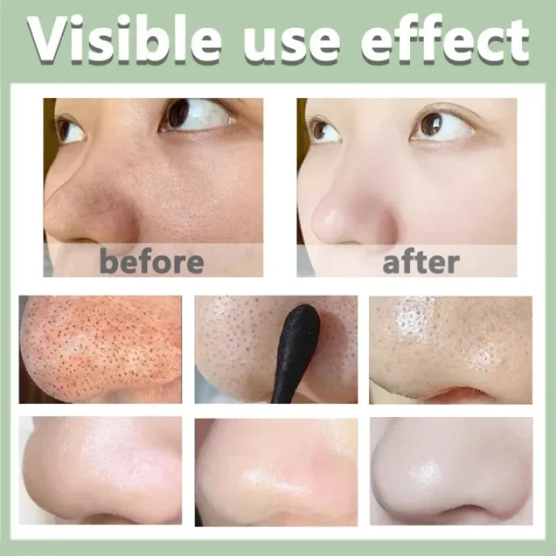 Original Green Tea Deep Remove Blackheads Acne Mud Mask Stick Shrink Pores Dispel Acne Cream Treat Pimple Korean Clean Skin Care