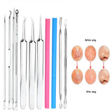 1PC Acne Clip Set Cell Clip Acne Needle Squeezing Blackhead Pressing Rod Cleaning Facial Stainless Steel Beauty Tool