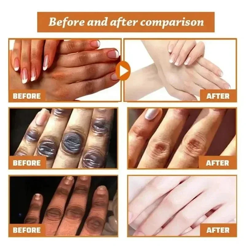 Clareamento Dark Knuckles Cream, Ilumine o creme de mãos Clarear Dull Corrector, Removedor de manchas hidratantes, Cuidados com a pele coreana