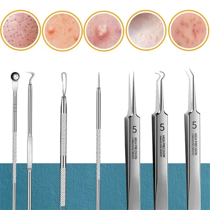11Pcs Acne Needle Professional Tweezers Acne Remover Ultra-fine No. 5 Cell Pimples Blackhead Clip Facial Pore Cleaning Care Tool