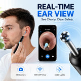 Smart Visual Ear Wax Remover with 1080P HD Camera, USB C Rechargeable Ear Cleaner, Waterproof Ear Scope Otoscope, Safe Ear Wax R