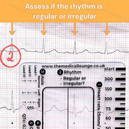 ECG 7 Step Ruler, Ruler Card for ECG/EKG Interpretation, Portable Pocket ECG EKG Reference Guide with Sheath, Emergency tool