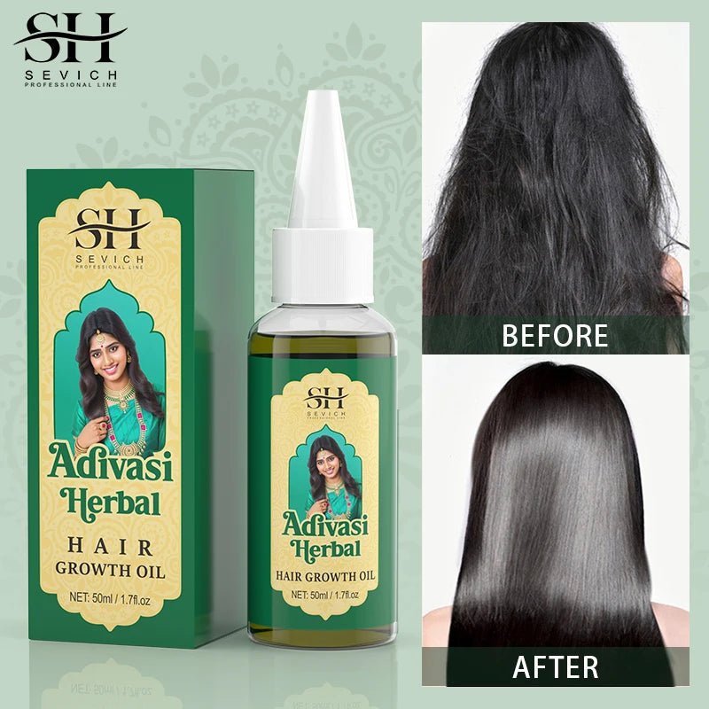 Aceite orgánico ayurvédico para el crecimiento del cabello, anticaída, regeneración capilar rápida, productos para el cabello grueso, Adivasi, India 