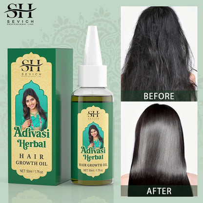 Aceite orgánico ayurvédico para el crecimiento del cabello, anticaída, regeneración capilar rápida, productos para el cabello grueso, Adivasi, India 