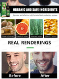 The most effective beard growth essence in 2025, grow a thick beard in 7 days. Chest hair, leg hair, beard and hair growth