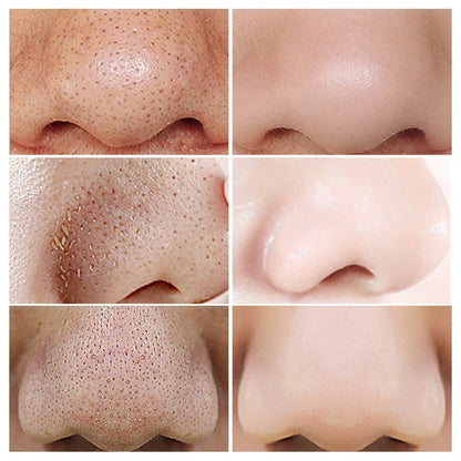 Original Green Tea Deep Remove Blackheads Acne Mud Mask Stick Shrink Pores Dispel Acne Cream Treat Pimple Korean Clean Skin Care