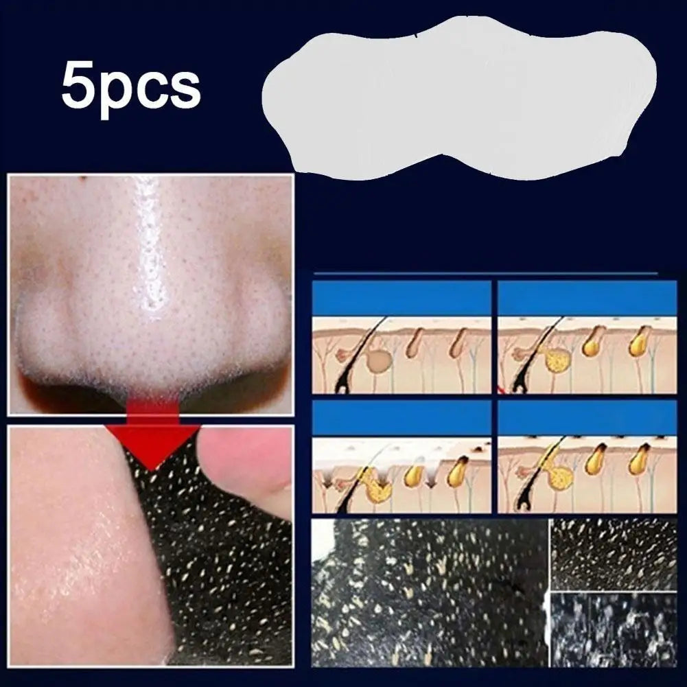 5pcs/lot Blackhead Remover Stickers Nasal Patch Deep Cleaning Shrink Pores Acne Treatment Nose Blackhead Mask Strips Skin Care