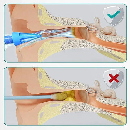 Ear Care Tool Household Cleaner Irrigation Kit Ear Wax Removal Tool Water Washing Syringe Comfortable Unique 12/20ML Health Care