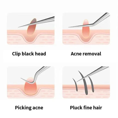 Acne Needle Tweezers Light Blackhead Blemish Pimples Removal Pointed Bend Head Face Care Tools Acne Extractor Beauty-health