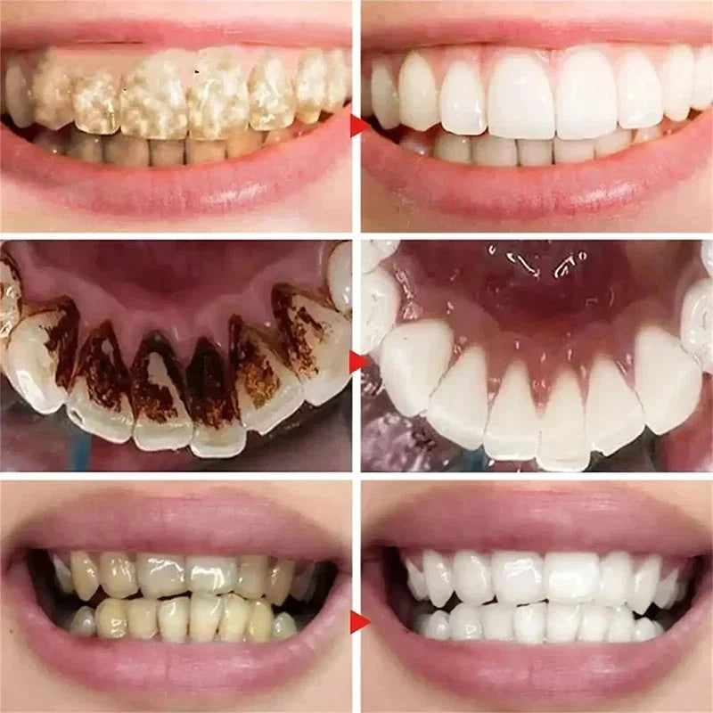 New Teeth Whitening Toothpaste 5D Oral Hygiene Cleaning Teeth Whitening Tool Fresh Breath Teeth Care
