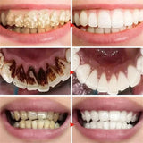 New Teeth Whitening Toothpaste 5D Oral Hygiene Cleaning Teeth Whitening Tool Fresh Breath Teeth Care