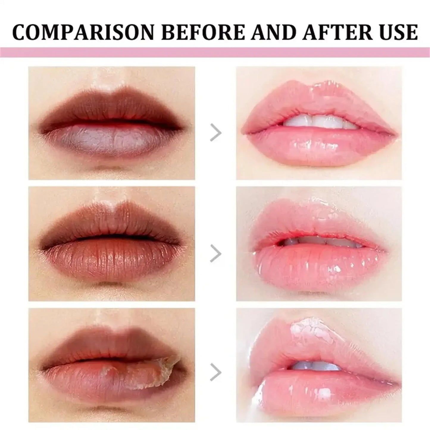 Remove Dark Lip Balm Lip Gloss Lighten Melanin Exfoliating Gloss Oil Moisturizing Lip Care Lipstick Korean Makeup Health Product