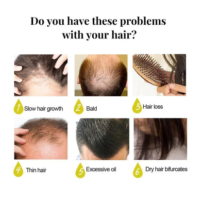 Óleo essencial de crescimento rápido e eficaz do cabelo, gengibre, prevenção da queda de cabelo, tratamento do couro cabeludo, produtos capilares mais grossos para homens e mulheres, 50ml