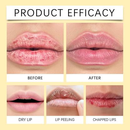 Remove Dark Lip Balm Lip Gloss Lighten Melanin Exfoliating Gloss Oil Moisturizing Lip Care Lipstick Korean Makeup Health Product