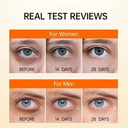 Suero de ojos antiojeras con retinol, antiarrugas, reafirmante, elimina bolsas, atenúa líneas finas, blanquea e ilumina. Cuidado de ojos coreano.