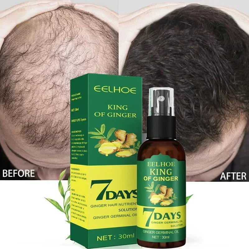 Óleo essencial de crescimento rápido e eficaz do cabelo, gengibre, prevenção da queda de cabelo, tratamento do couro cabeludo, produtos capilares mais grossos para homens e mulheres, 50ml