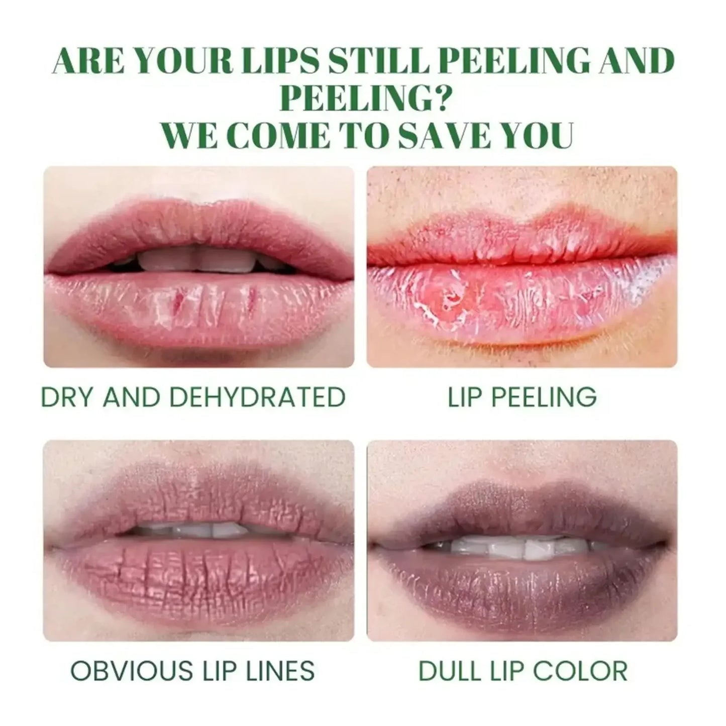 Remove Dark Lip Balm Lip Gloss Lighten Melanin Exfoliating Gloss Oil Moisturizing Lip Care Lipstick Korean Makeup Health Product