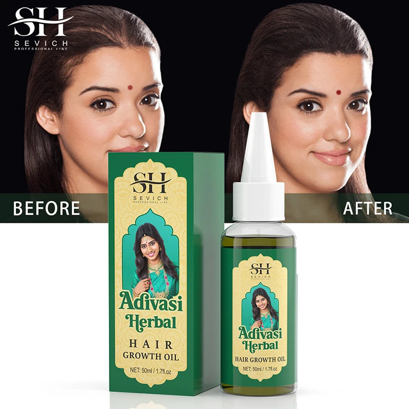 Óleo de Crescimento Do Cabelo Orgânico Ayurvedic, Anti Perda De Cabelo, Recrescimento Rápido, Engrossar Produtos De Cabelo, Adivasi, Índia