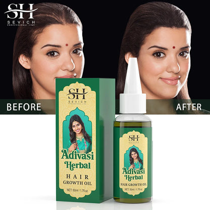 Aceite orgánico ayurvédico para el crecimiento del cabello, anticaída, regeneración capilar rápida, productos para el cabello grueso, Adivasi, India 