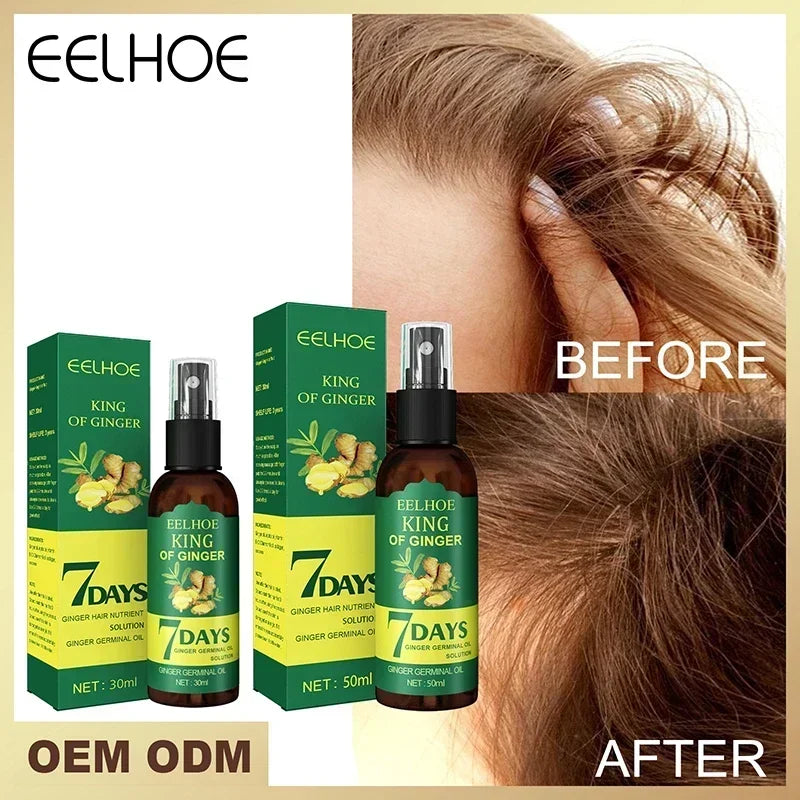 Óleo essencial de crescimento rápido e eficaz do cabelo, gengibre, prevenção da queda de cabelo, tratamento do couro cabeludo, produtos capilares mais grossos para homens e mulheres, 50ml