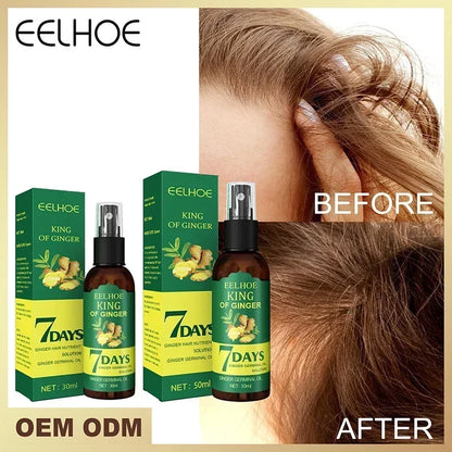 Óleo essencial de crescimento rápido e eficaz do cabelo, gengibre, prevenção da queda de cabelo, tratamento do couro cabeludo, produtos capilares mais grossos para homens e mulheres, 50ml