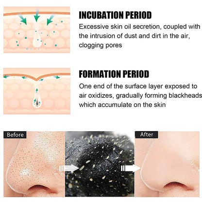 10PCS Unisex Blackhead Remove Mask Nasal Strips Shrink Cleansing Pore Nose Black Head Remove Stickers Skin Care Mask Patch