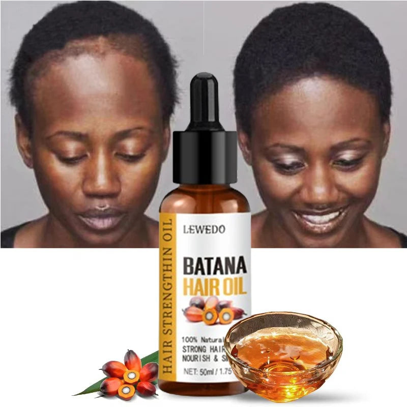 Óleo de Batana Lewedo Naturals – Crescimento Acelerado do Cabelo para Homens e Mulheres – Óleo de Batana Puro – Nutrição e Brilho – Cuidado Capilar Saudável – Combate à Queda