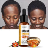 Óleo de Batana Lewedo Naturals – Crescimento Acelerado do Cabelo para Homens e Mulheres – Óleo de Batana Puro – Nutrição e Brilho – Cuidado Capilar Saudável – Combate à Queda